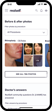 Original RealSelf profile, Before and After photos and the doctor's answers Q and A section.