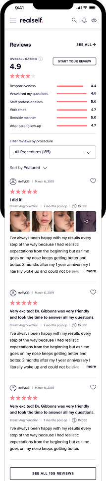 Original RealSelf profile, reviews: overall rating, rating breakdown, and individual patient reviews.